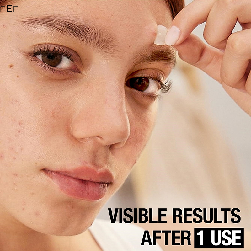 〔E〕360Pcs Invisible Pimple Rem – Beauty Zone Makeup recenzja i cena